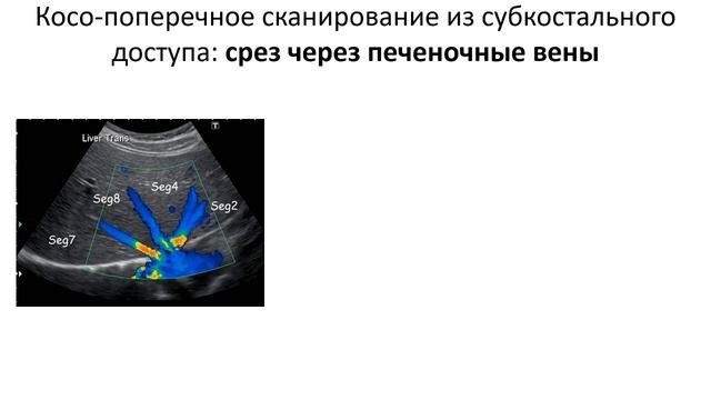 Сегменты печени.