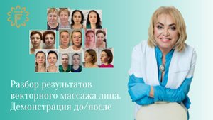 Разбор результатов векторного массажа лица. Демонстрация до/после.