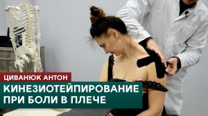 Кинезиотейпирование при боли в плече. Циванюк Антон