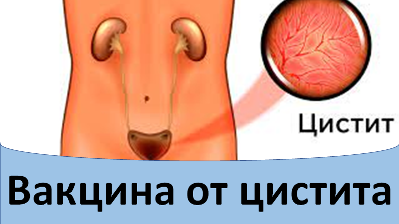 Вакцина от цистита