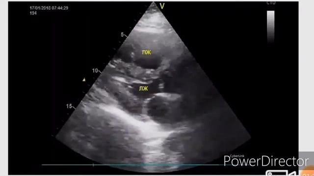 Тэла эхокг смотреть онлайн