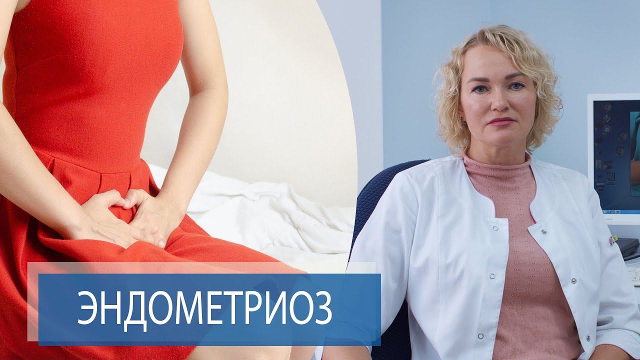 БОЛЕЗНЕННЫЕ МЕНСТРУАЦИИ | Эндометриоз смотреть онлайн