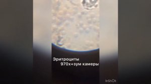 Эритроциты 900х под микроскопом микромед 100 -900
