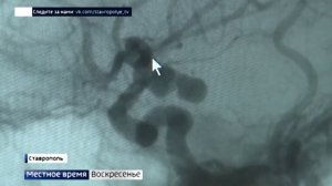 На Ставрополье врачи успешно оперируют пациентов с аневризмой головного мозга