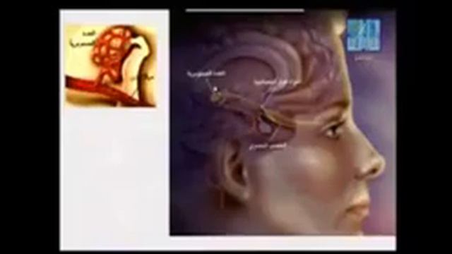 АЛЛАХ ВЕЛИК. АЛЛАХУ АКБАР. ЛЕЧИТЕ СЕБЯ И СВОИХ БЛИЗКИХ КОРАНОМ❤ смотреть онлайн