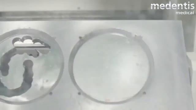 Теперь в Молдавии! ICX-templant: «народные импланты» из Германии смотреть онлайн