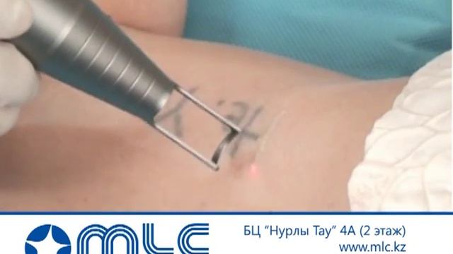 ТОО "Медицинский лазерный центр" смотреть онлайн