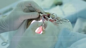 Полная ринопластика