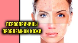 Первопричины проблемной кожи лица, головной боли и деформации зубов. Руденко В.В. Академия Целителей