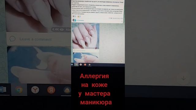 Как избавиться от аллергии на коже? Шелушение кожи у мастера маникюра. Аллергия на гель-лак. Детокс