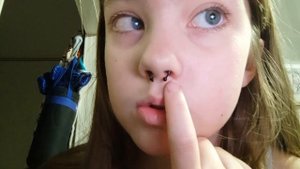 Септум обманка?