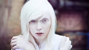 Кто такие люди альбиносы؟