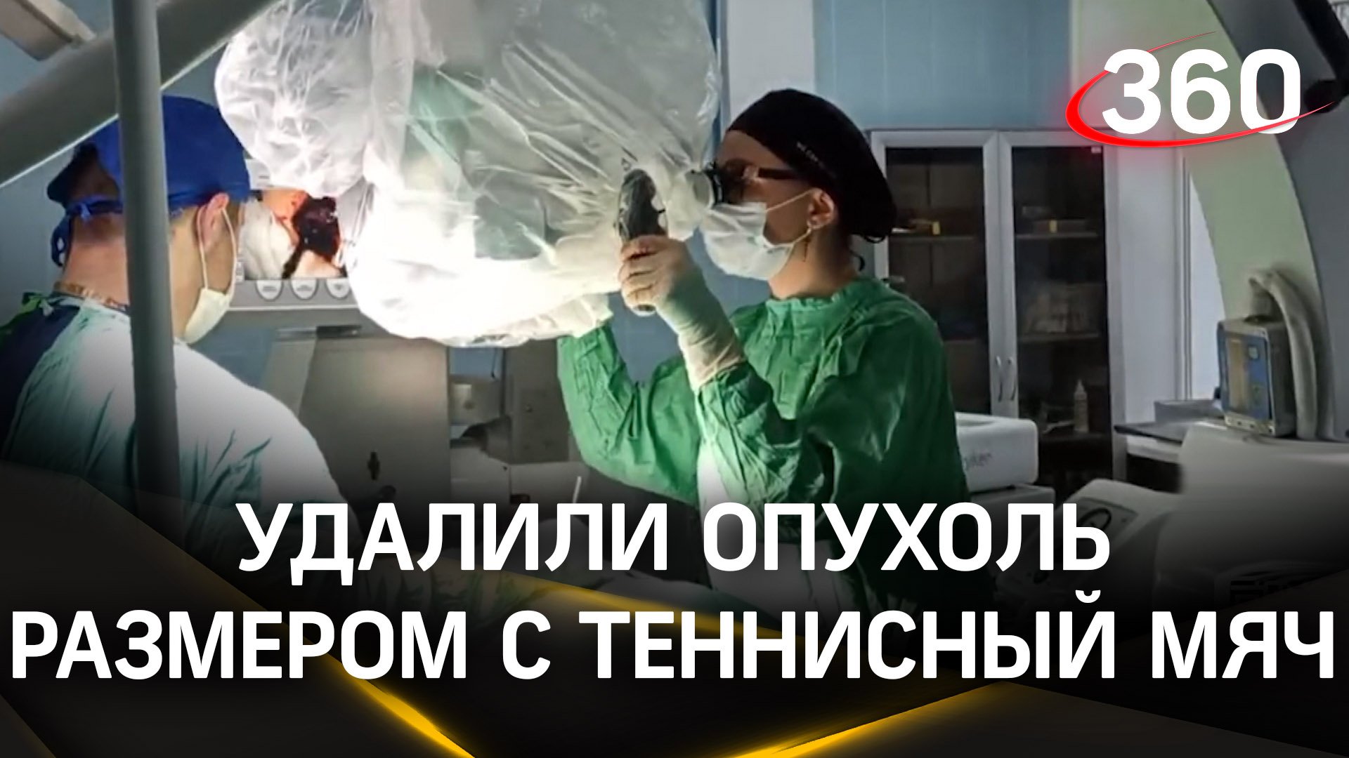 Люберецкие нейрохирурги удалили у пациента новообразование в мозге размером с теннисный мяч