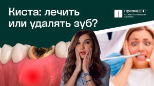 😳 Киста зуба: как вылечить или удалять с зубом?