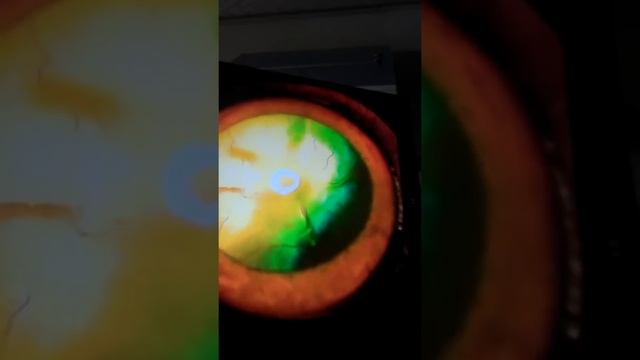 Офтальмология Эндоскопический осмотр глазного дна. смотреть онлайн