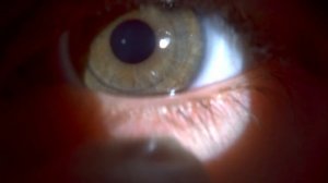 Посадка торических мягких контактных линз OKVision® Prima Bio Toric (левый глаз)