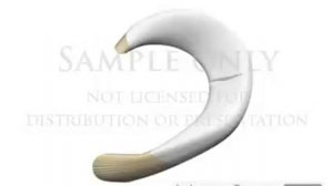 Биомеханика менисков. Анимация.