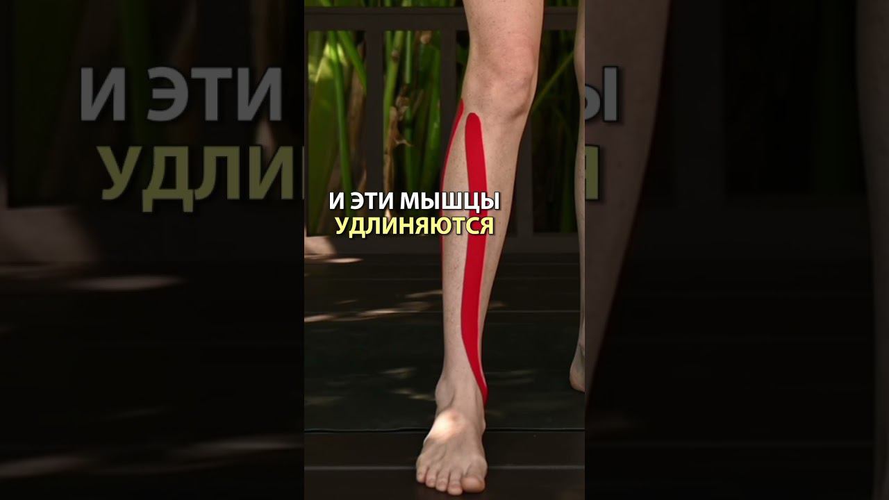 Плоскостопие. Почему?