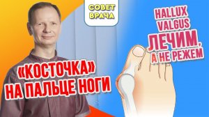 Шишка на большом пальце ноги или hallux valgus.Что делать?