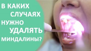 Удаление миндалин ✂ В каких случаях требуется удаление миндалин. Доктор ЛОР.