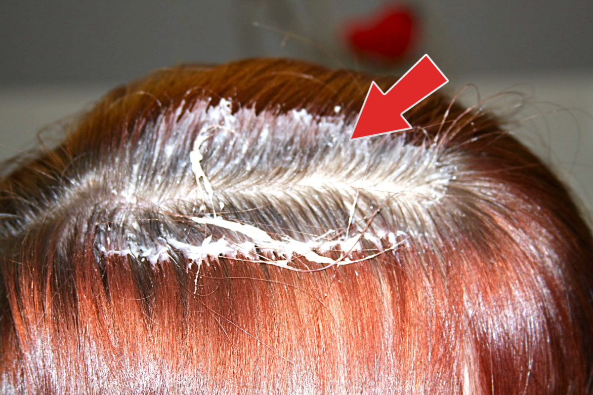 От этого волосы восстанавливаются мгновенно! смотреть онлайн