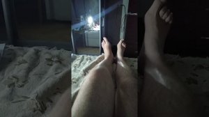 Перелом мыщелка большеберцовой кости. 4 день после снятия гипса.