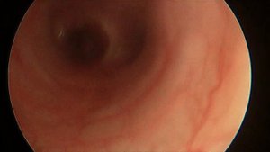 Бронхоальвеолярный лаваж у кошки | Bronchoalveolar Lavage (BAL)