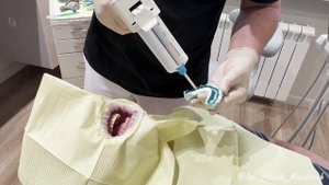 Посмотреть заранее на будущие зубы. Примерка будущих зубов. Перевод #waxup в #mockup.