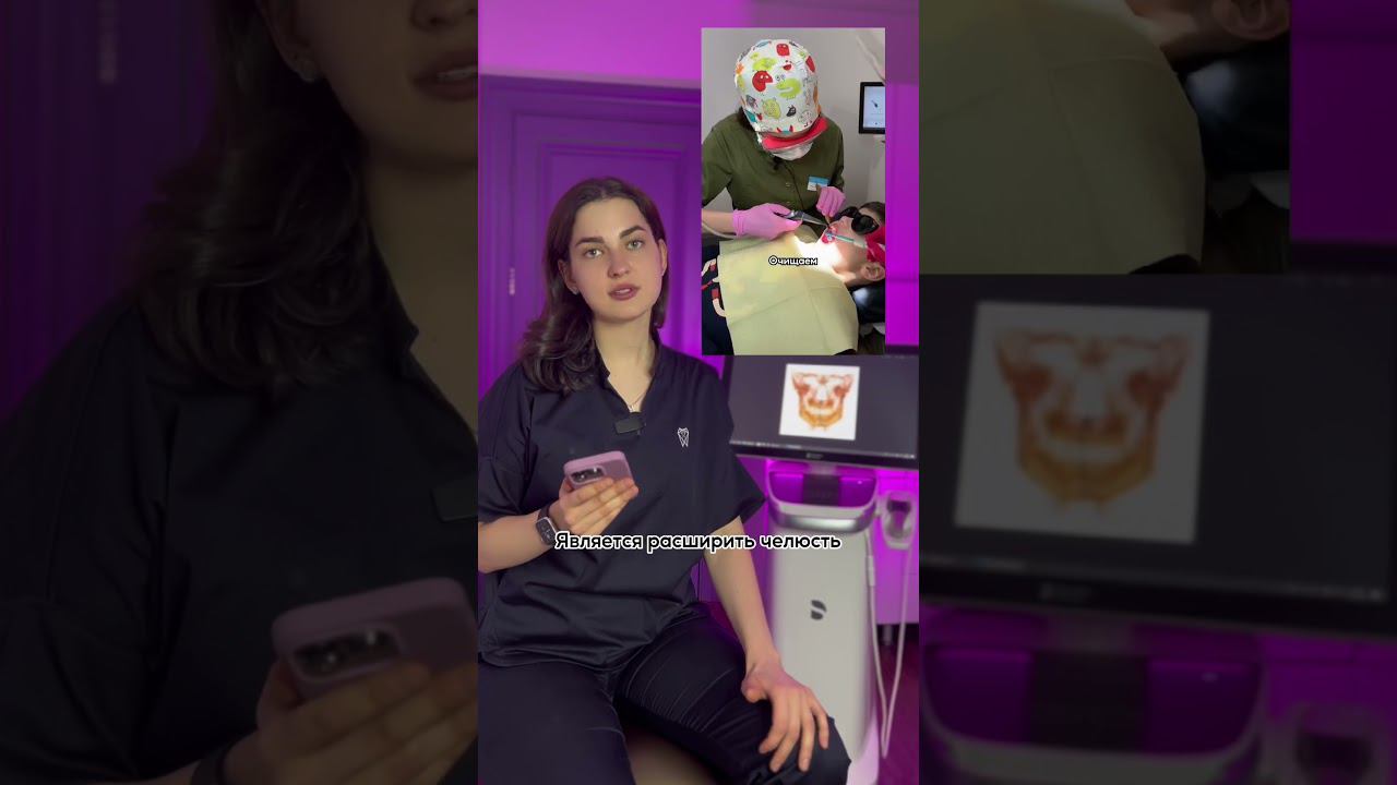 Больно ли устанавливать аппарат Роса❓
