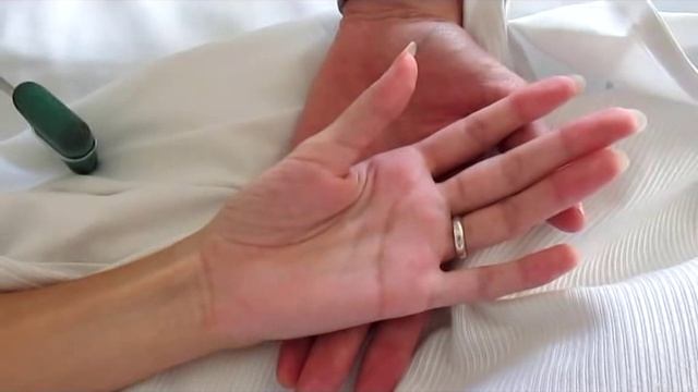 Miotonía - Myotonia