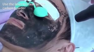 carbon peeling treatment / углерода пилинг лечение