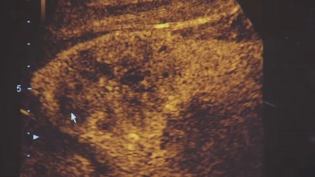 Отделение ультразвуковой диагностики смотреть онлайн