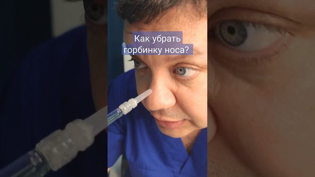 Как убрать горбинку носа?