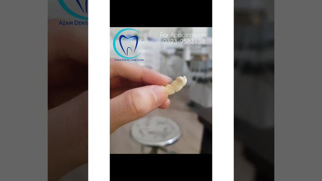 Dental Bridge