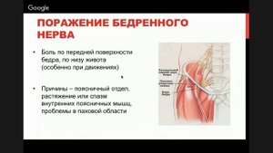 ► Остеохондроз   теория  Боли по передней поверхности бедра