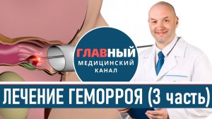 Лечение геморроя (3). Как и чем лечить внутренний геморрой после родов и при беременности