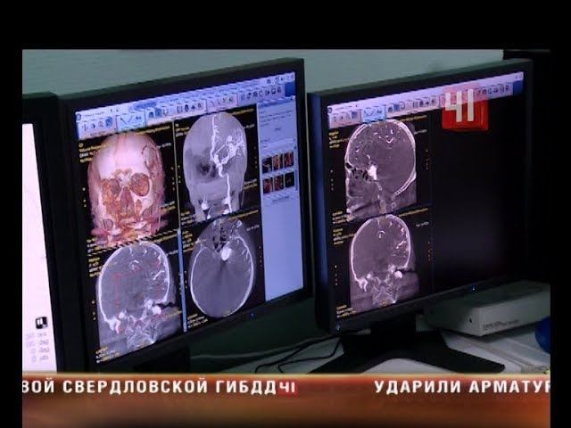 Операция на сосудах головного мозга