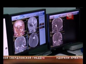 Операция на сосудах головного мозга