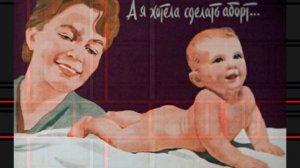 Как проводились аборты в  Советском Союзе