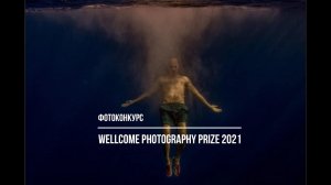 фотоконкурс Wellcome Photography Prize 2021 / Deadlone 2021.01.18