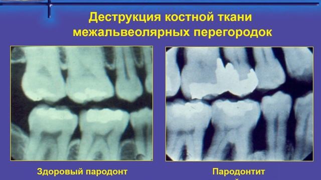 Тактика врача стоматолога при проведении профилактических мероприятий у пациентов с различными восп смотреть онлайн
