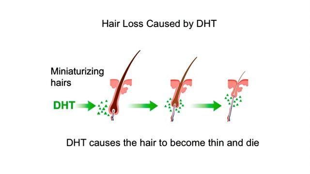 Limitations, Ineffectiveness of PRP, Mesotherapy Hair Loss Treatments, and a Better Alternative