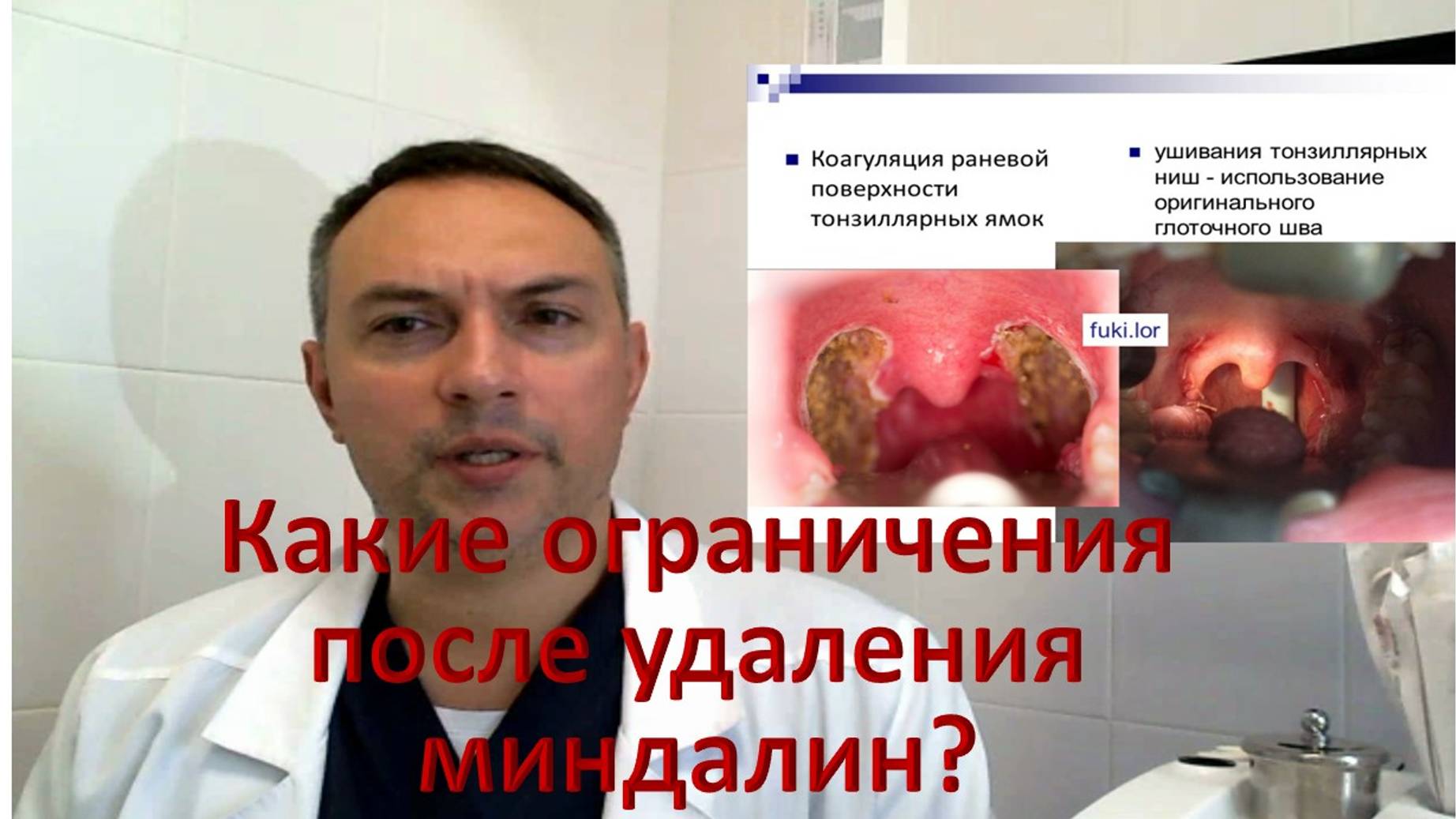 Нельзя делать после удаления миндалин, запрещено после тонзиллэктомии реабилитация и восстановление смотреть онлайн