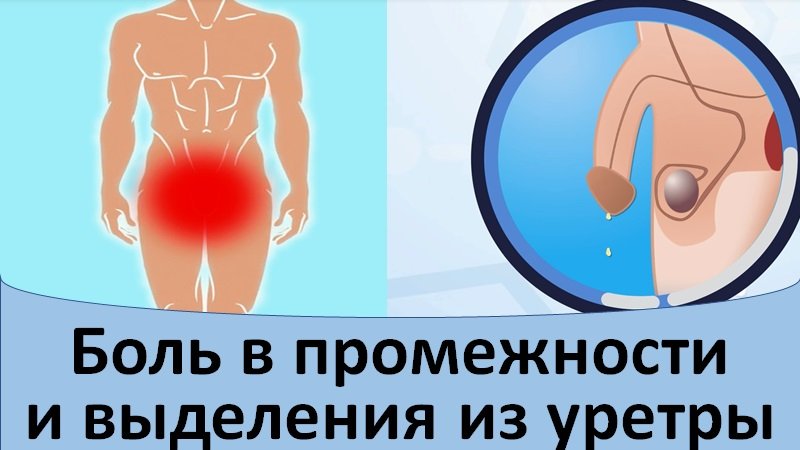 Боль в промежности и выделения из уретры.