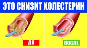 Как снизить холестерин. Снижение холестерина., фитостерины