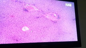 Гистология Печень человека [Пищеварительная система]