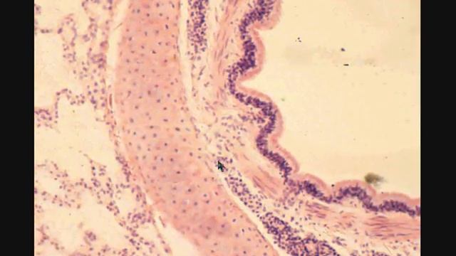 ЛЕГКОЕ  LUNG  гистологическое строение
