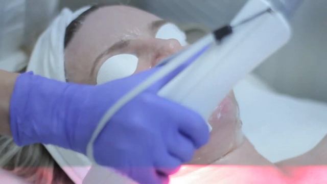 SkinTyte | First Ave Medical Spa | Vancouver смотреть онлайн