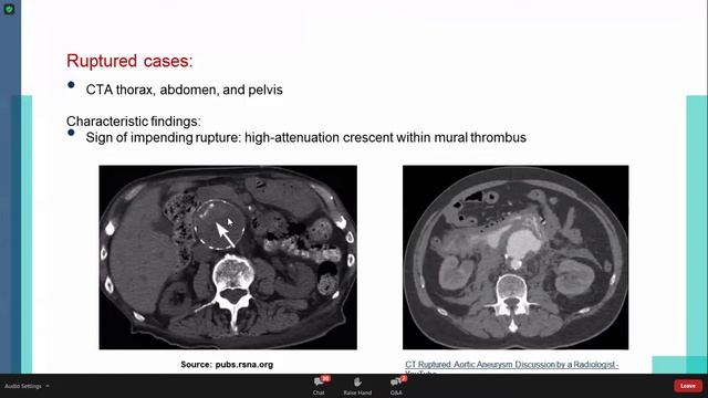 GIT II - General Surgery || SMLE Crash Course смотреть онлайн