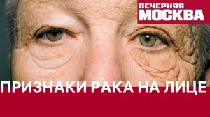 Как определить признаки рака по лицу